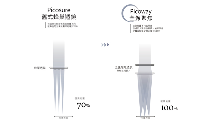 台中菲仕美診所亦配備擁有532nm、785nm、1064nm三波長的美國PicoWay全像超皮秒，搭配原廠全像透鏡，有效治療淺層斑點、深層斑點、混合型斑點。