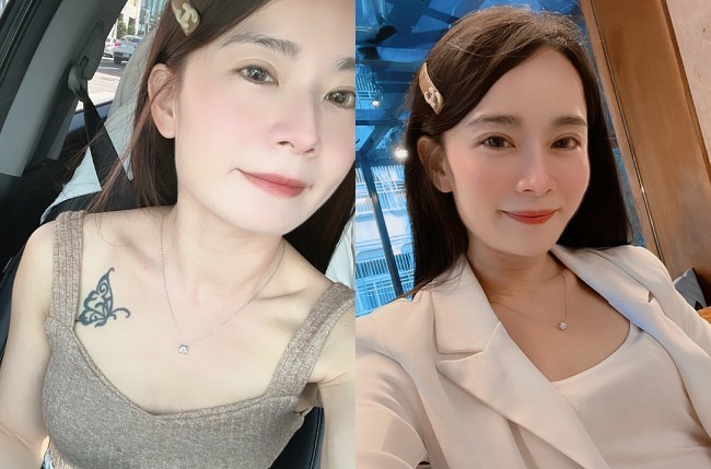 JOY魔滴隆乳手術前