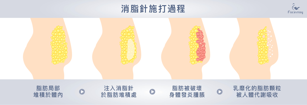 消脂針作用機制，消脂針施作過程，產後肥胖、產後瘦身、消脂針、消針針原理，減肥、善纖達、減肥點滴、瘦身方法