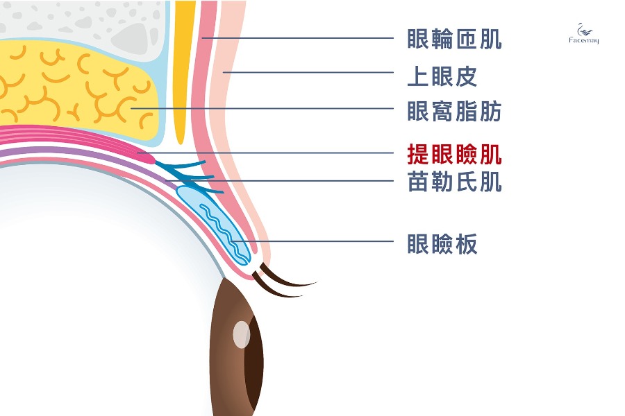 提眼瞼肌是什麼?