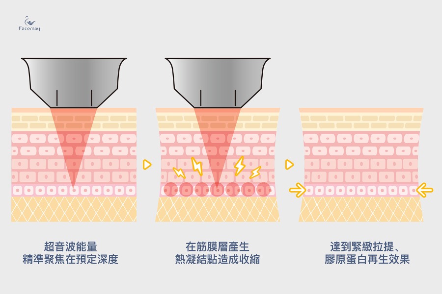 音波拉提作用原理簡介