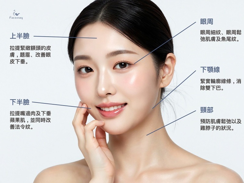 音波拉提適用部位