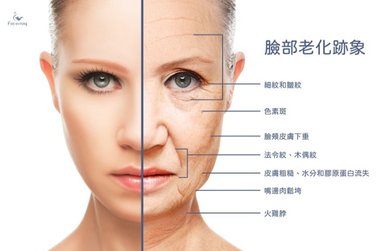 為什麼玻尿酸填補這麼受歡迎?