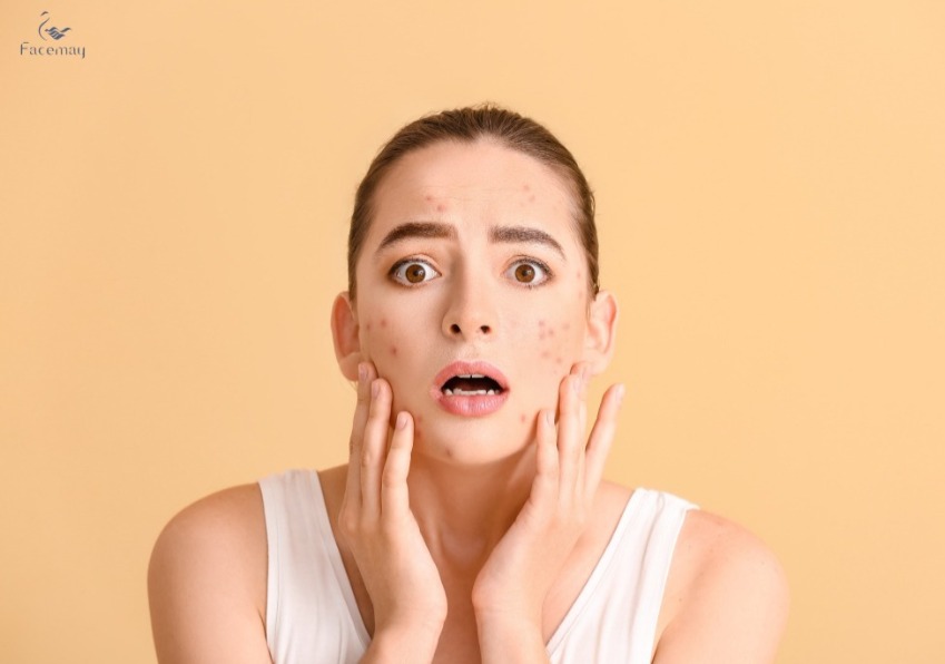 肝斑出現怎麼辦?最有效又不容易復發的方法大公開!