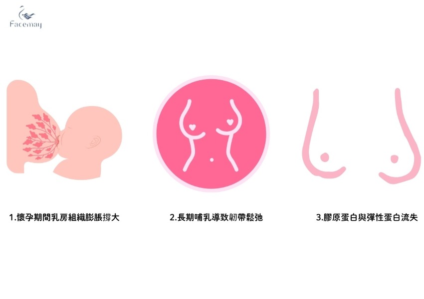 一、產後胸部下垂的三大主因