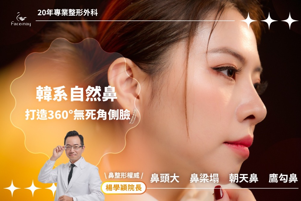 FitMe韓國完形美臉部植入物:打造專屬你的自然輪廓