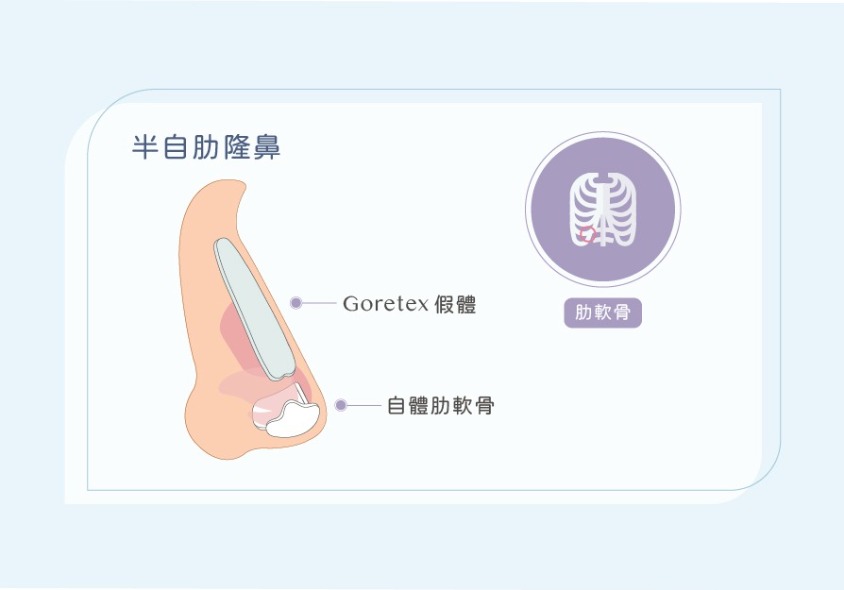 完形美FITme|訂製流程