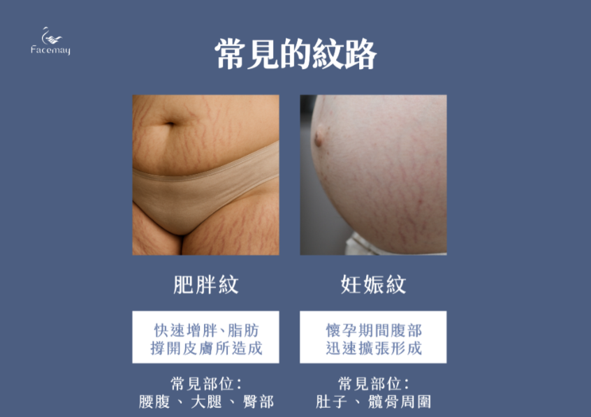 FitMe完形美適用部位