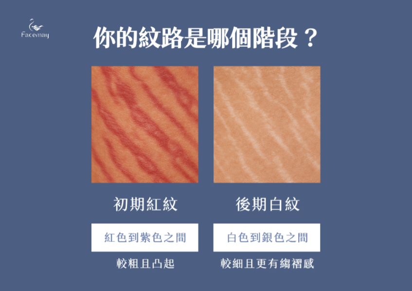 FitMe完形美的優勢