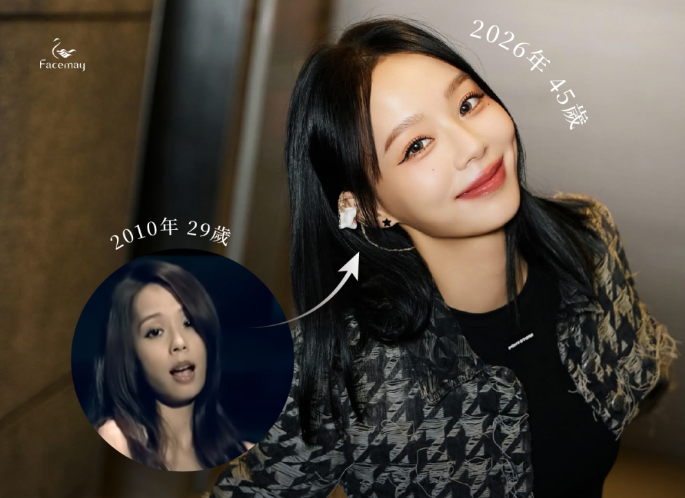 FitMe韓國完形美臉部植入物:打造專屬你的自然輪廓