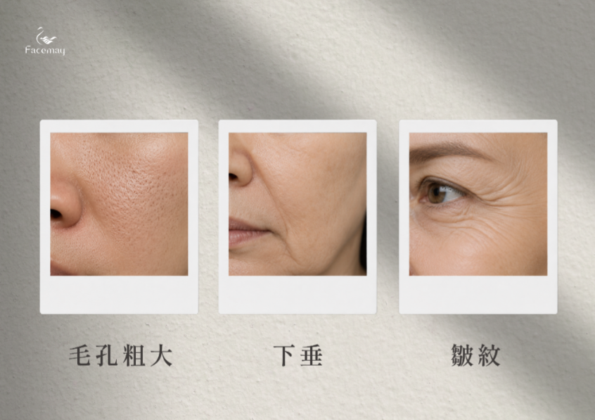FitMe完形美適用部位