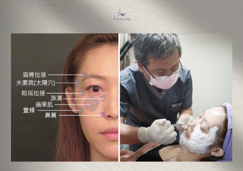 FitMe完形美適用部位