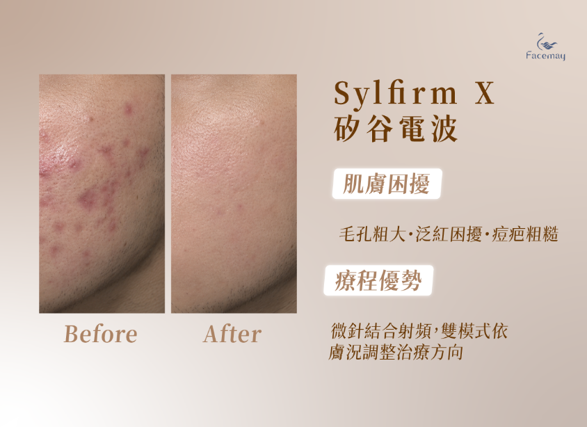 FitMe完形美適用部位