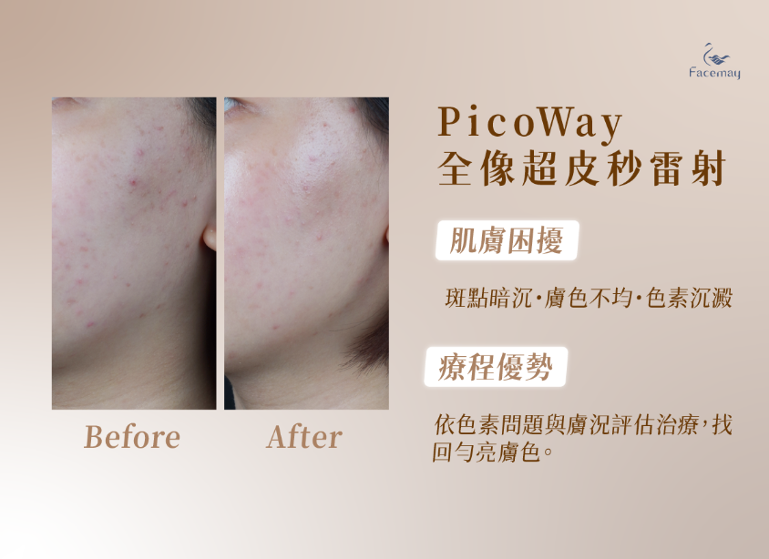 FitMe完形美的優勢