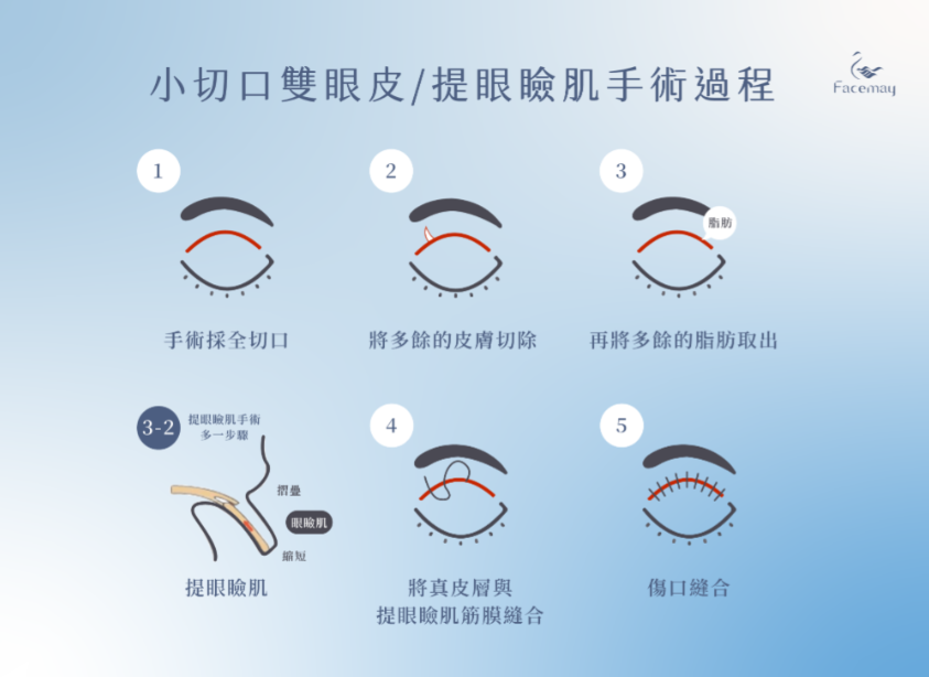 FitMe完形美的優勢