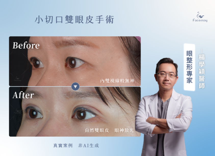FitMe完形美的優勢