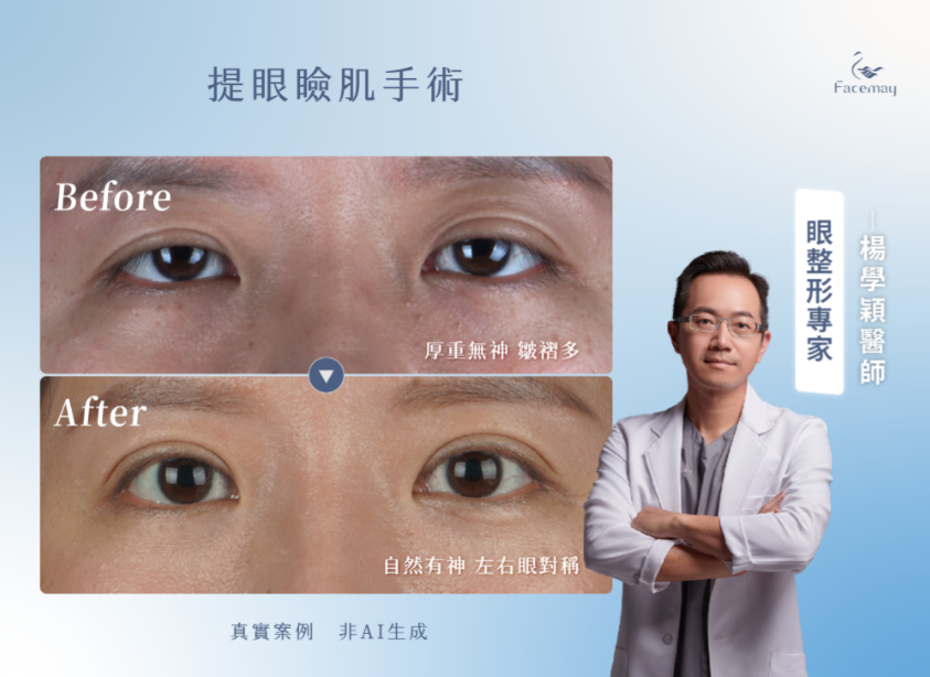 FitMe完形美適用部位