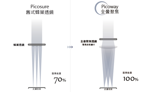 皮秒PTT,舊式蜂巢透鏡價格不等於效果,去斑有感術後心得