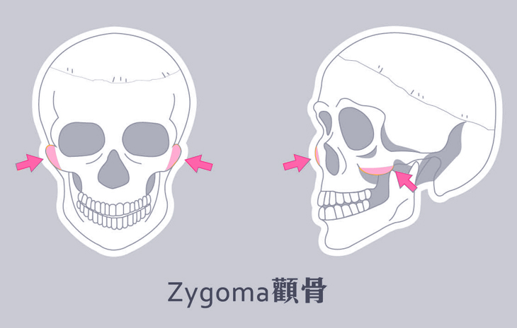削骨手術：顴骨、下顎骨、下巴三部位客製化精緻小臉