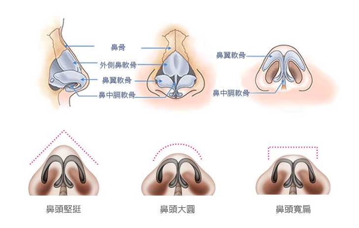 鼻頭手術適用對象：鼻頭過大、過小、角度過度向上或下垂，影響美觀者。