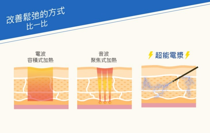 電波音波與超能電漿的比較 電波音波與超能電漿的比較