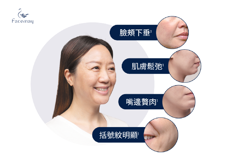 「AestheFill艾麗斯聚雙旋乳酸」為專為亞洲人設計的長效型膠原蛋白增生劑，治療後皮膚自然柔軟，膚觸宛若天生，即使是二次注射也不會有僵硬感。