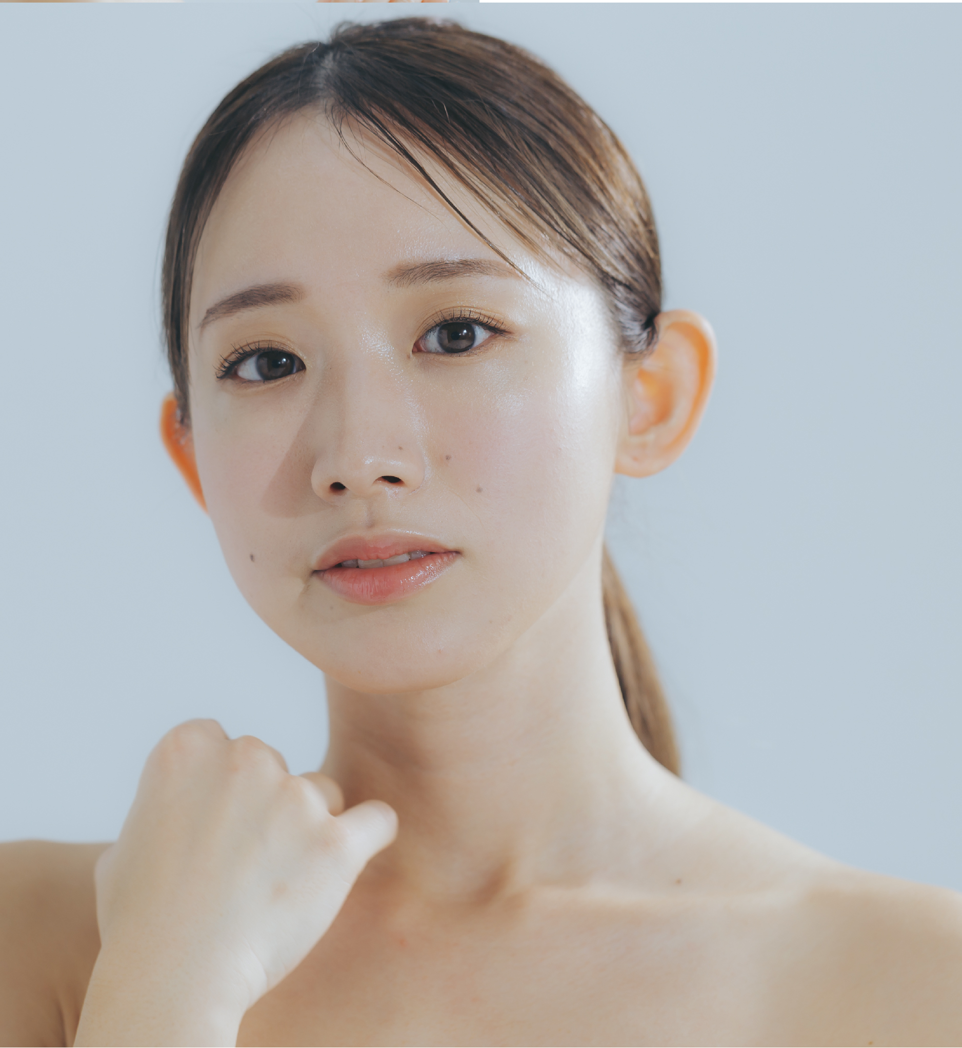 Juvederm®喬雅登®玻尿酸