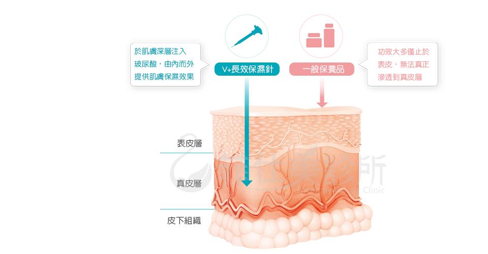 改良HYLACROSS交聯鍵結科技