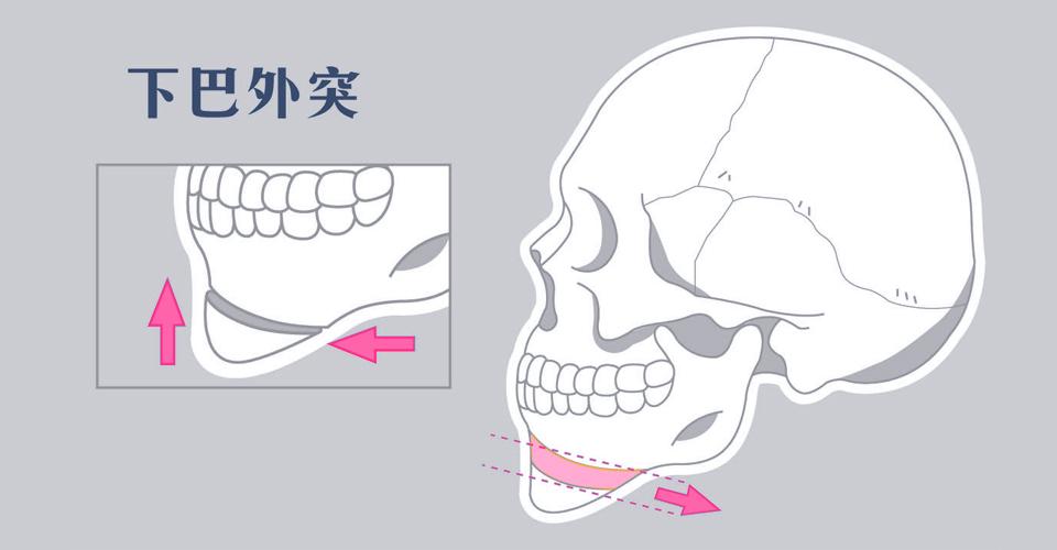 縮小面積