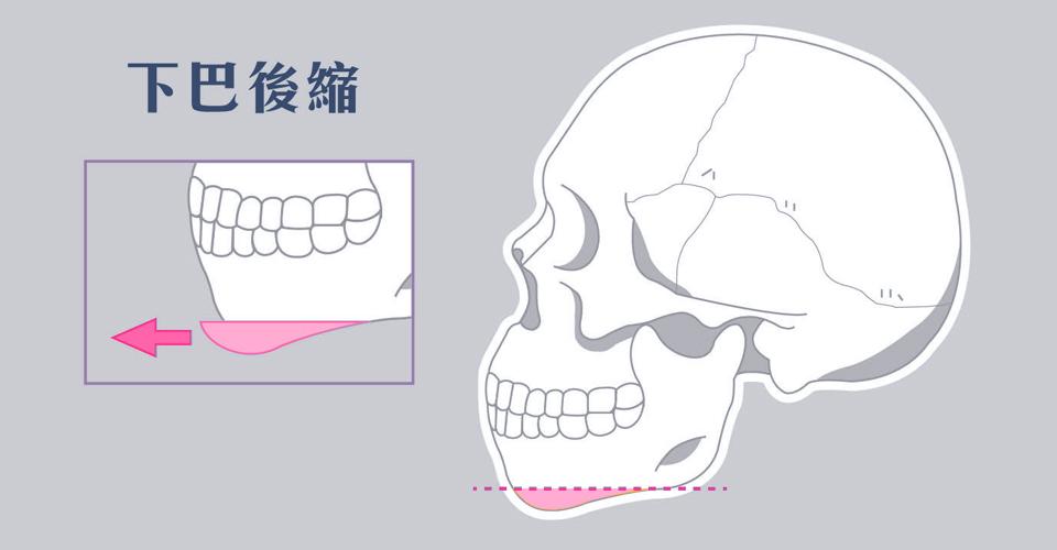 使面部線條柔順