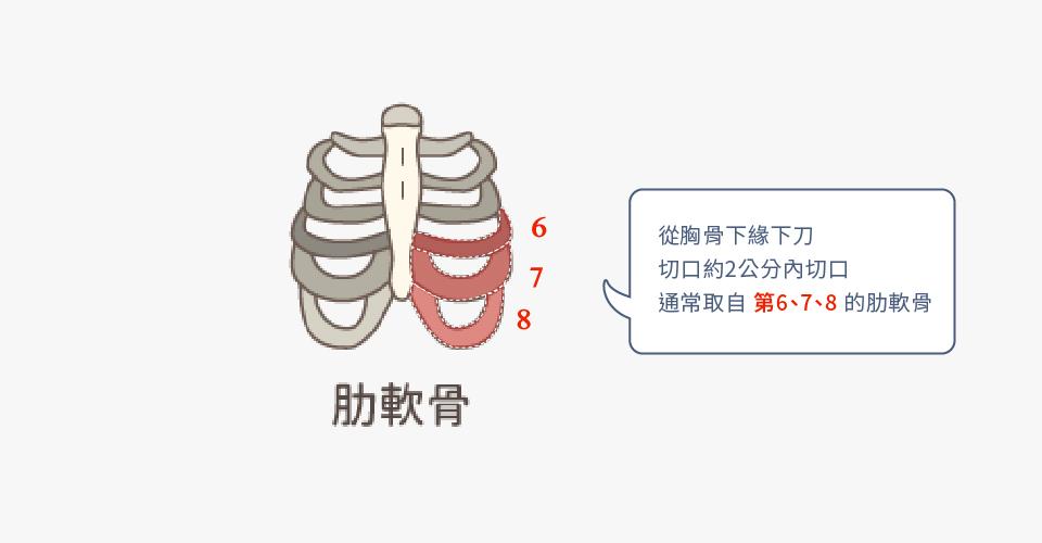 自體材質相容性高