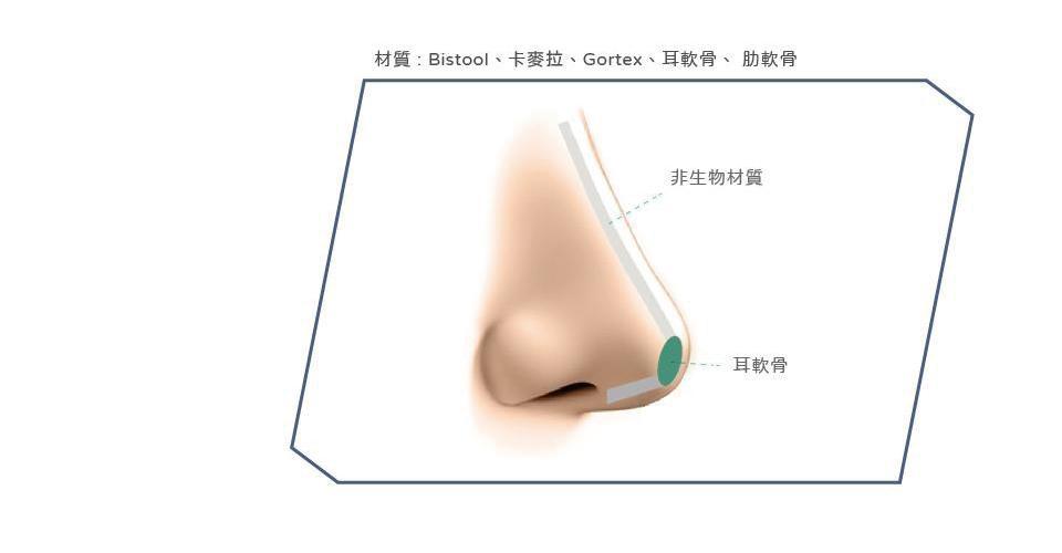 安全性較高