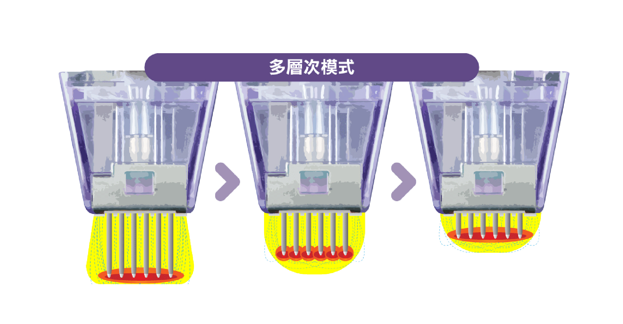 多種釋放模式